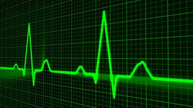 A green electrocardiogram (ECG) line on a black grid background displaying heart activity with regular peaks and troughs, representing a typical heartbeat in modern healthcare.